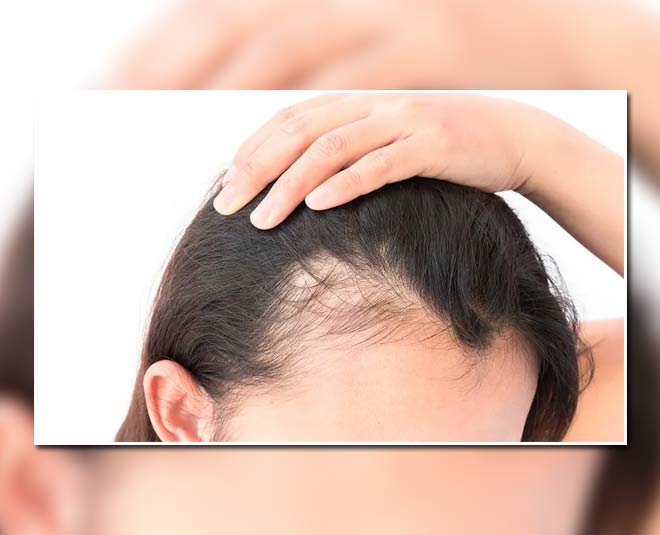 hair and fall