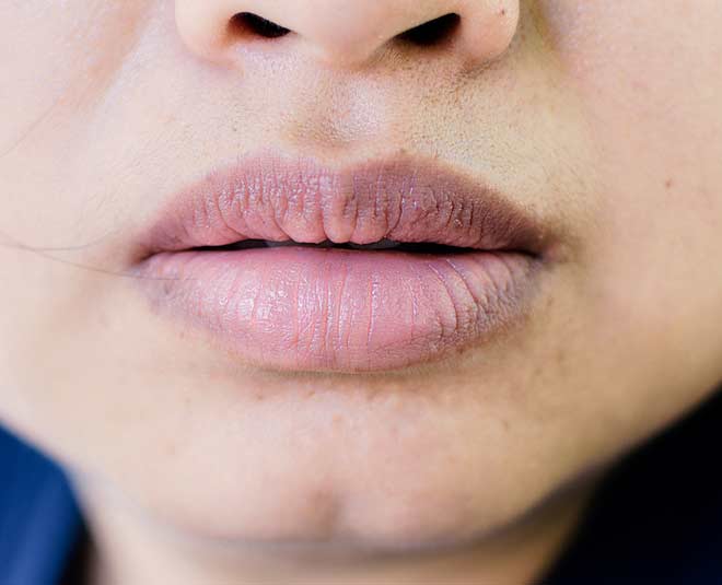 dark lips chemical treatment