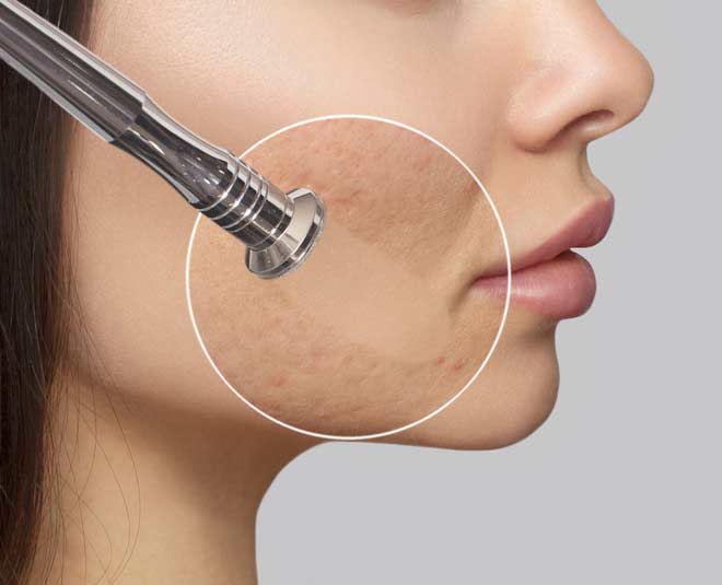 derma skin treatment