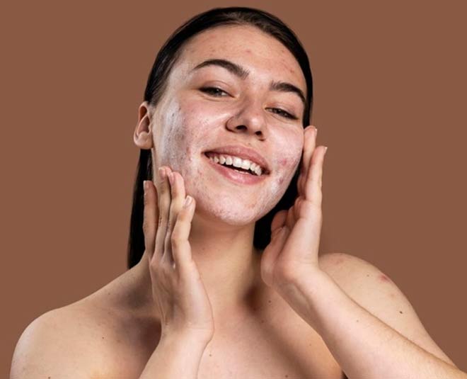 how to fix open pores