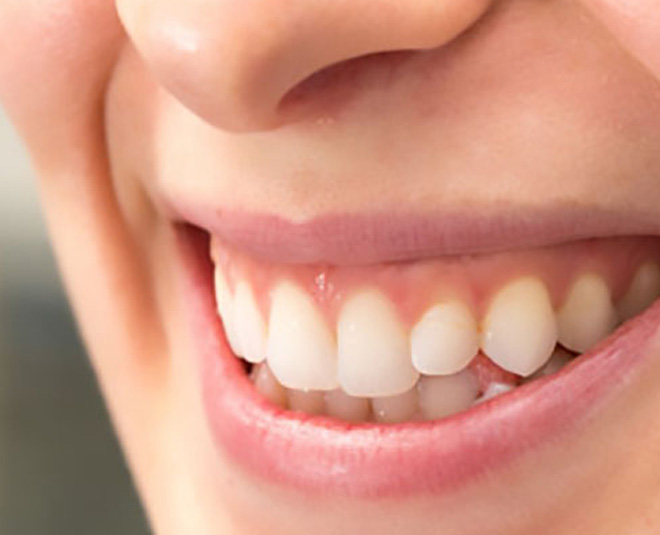 know ayurveda tips for receding gum