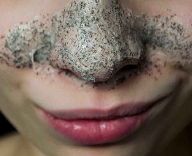 nose whiteheads removal strips