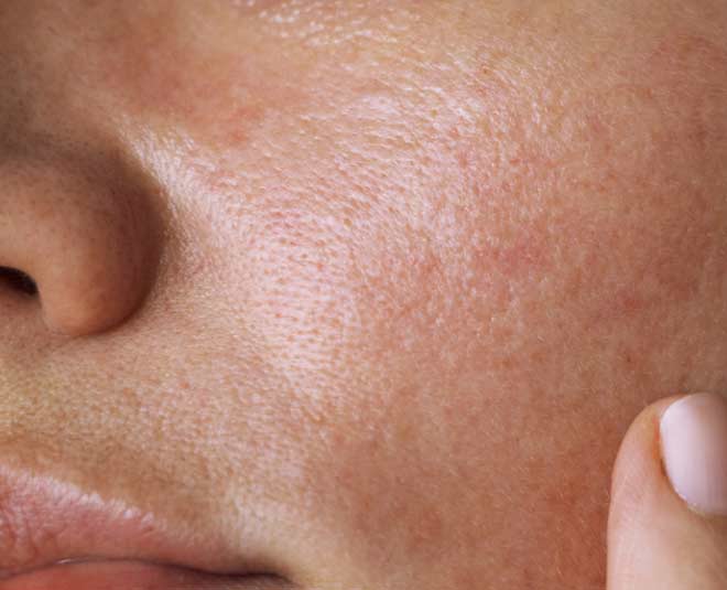 oily skin care routine monsoon