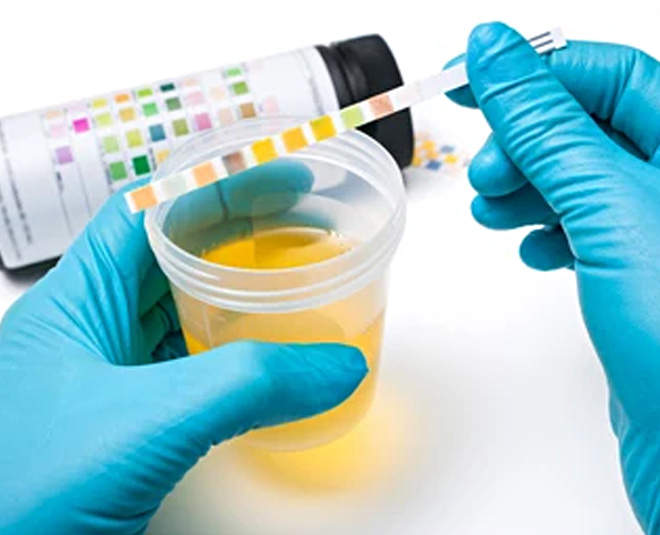 urine tests