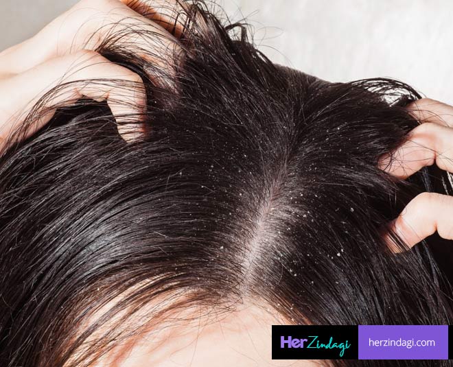 scalp care jawed habib