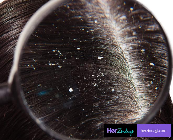 scalp tips jawed habib