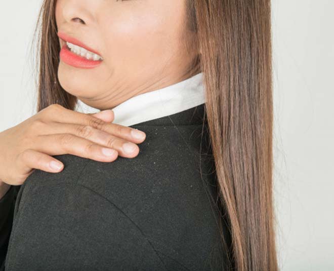 dandruff treatment inside