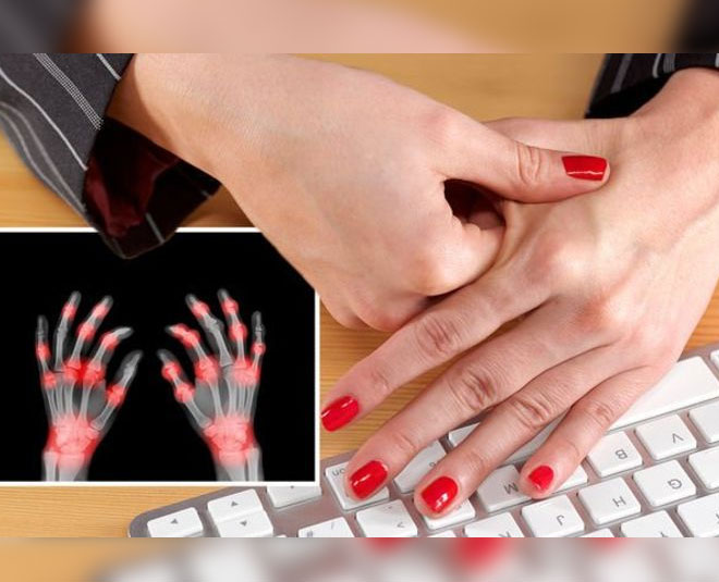 What Is Rheumatoid Arthritis