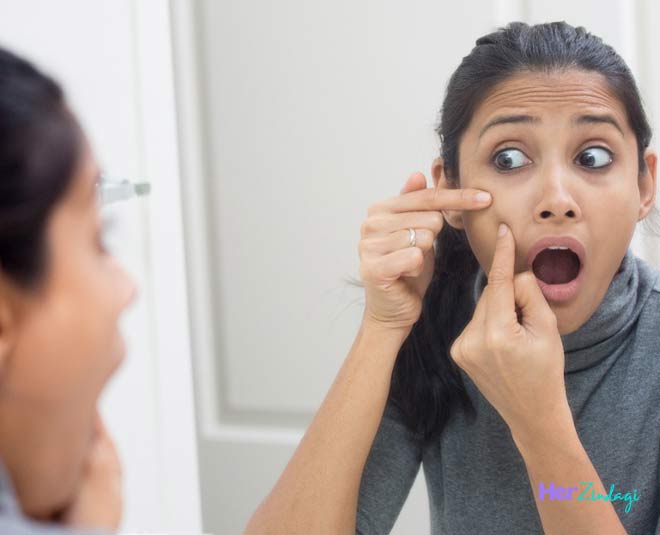 cleaning blackheads