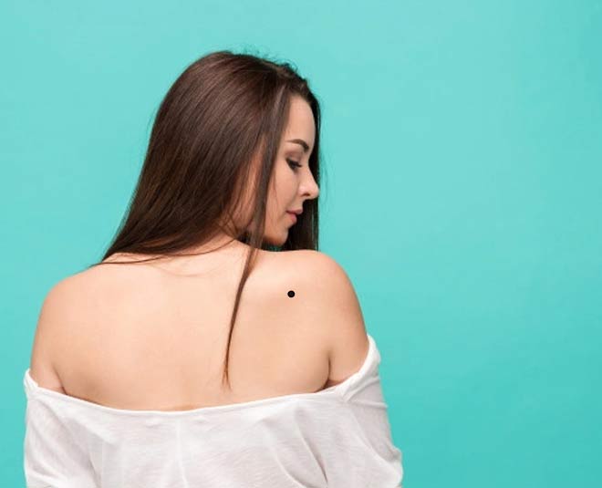 mole on back