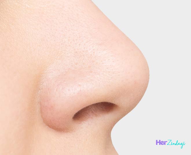 oily nose