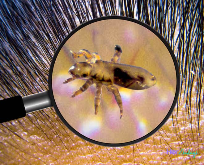 home remedies lice hair