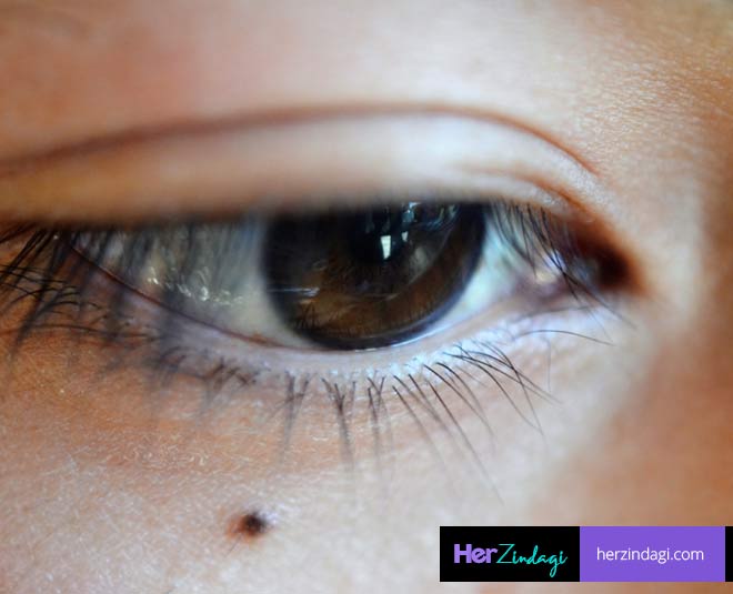 moles on eyes meaning
