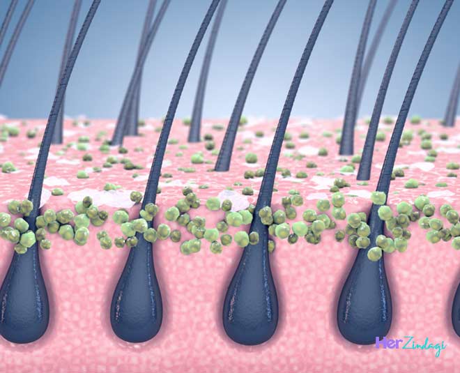 sticksy scalp and dandruff