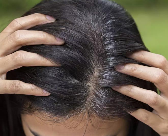 grey hair and issues for young