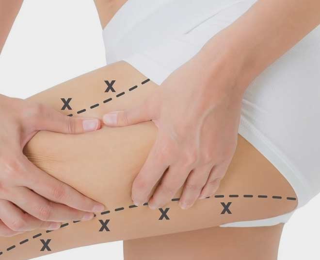 reduce thigh and hip fat