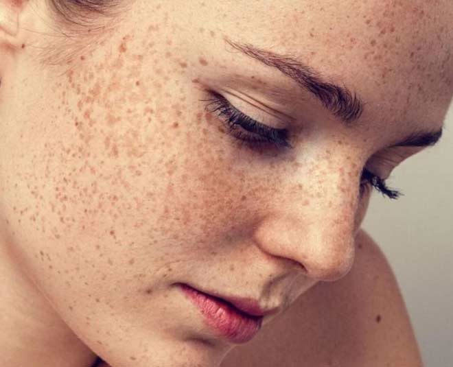 banana peel for pigmentation