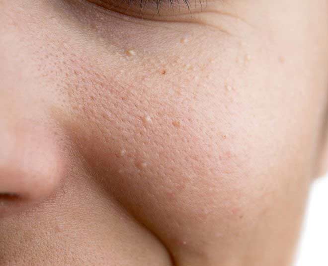 skin texture and bumps