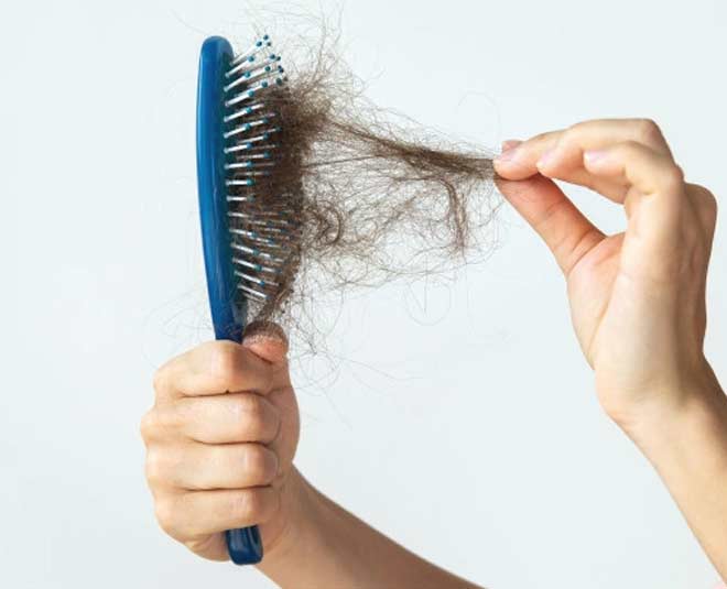 female hair fall and issues