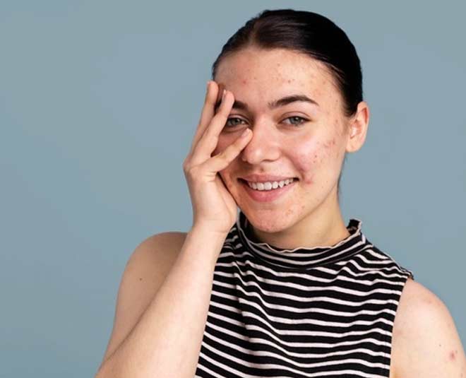 sensitive skin for winter changing weather