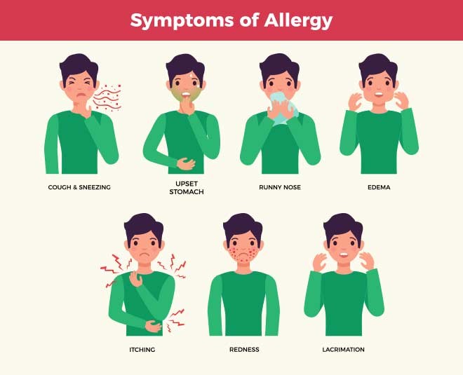 Urticaria symptoms