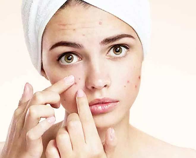 cucumber peel for pimples