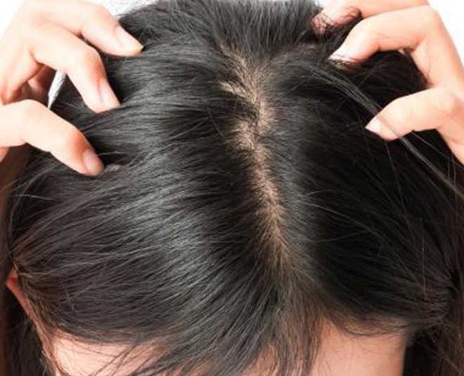 scalp and hair thin