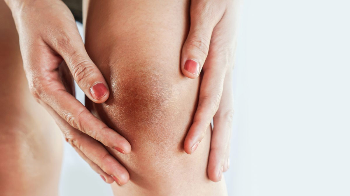 dark knee and skin problems