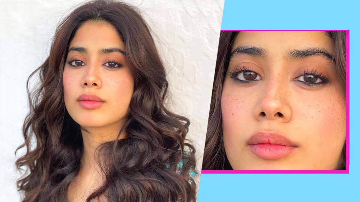 what causes frackles on face