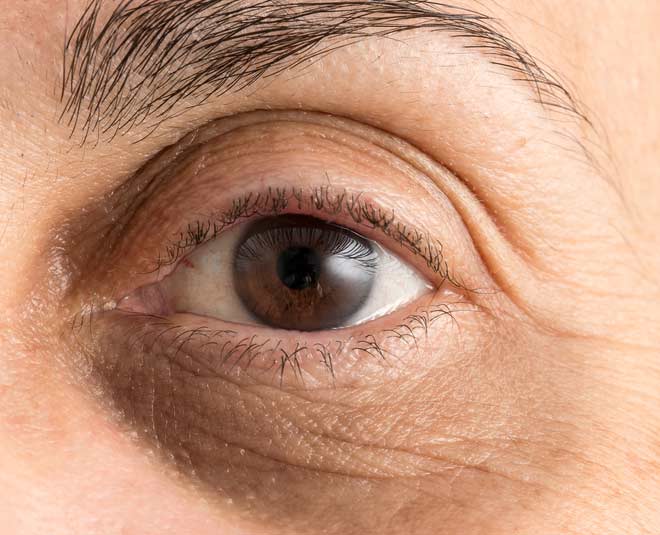 eye care for dark circles