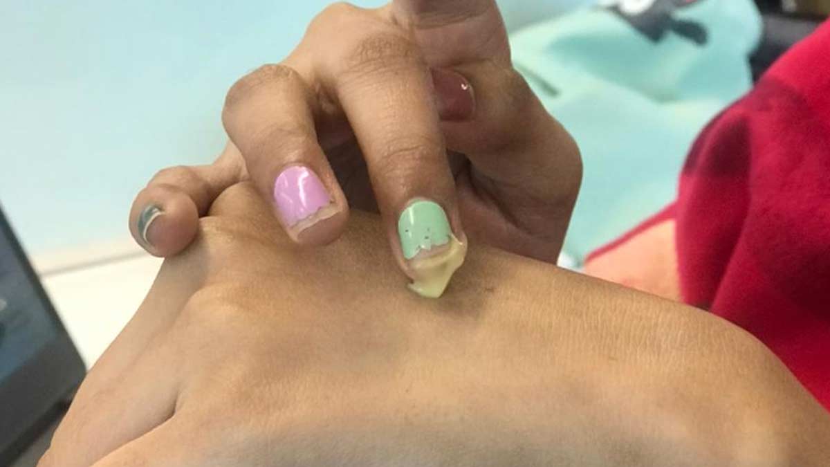 benefits of using moisturizing cream