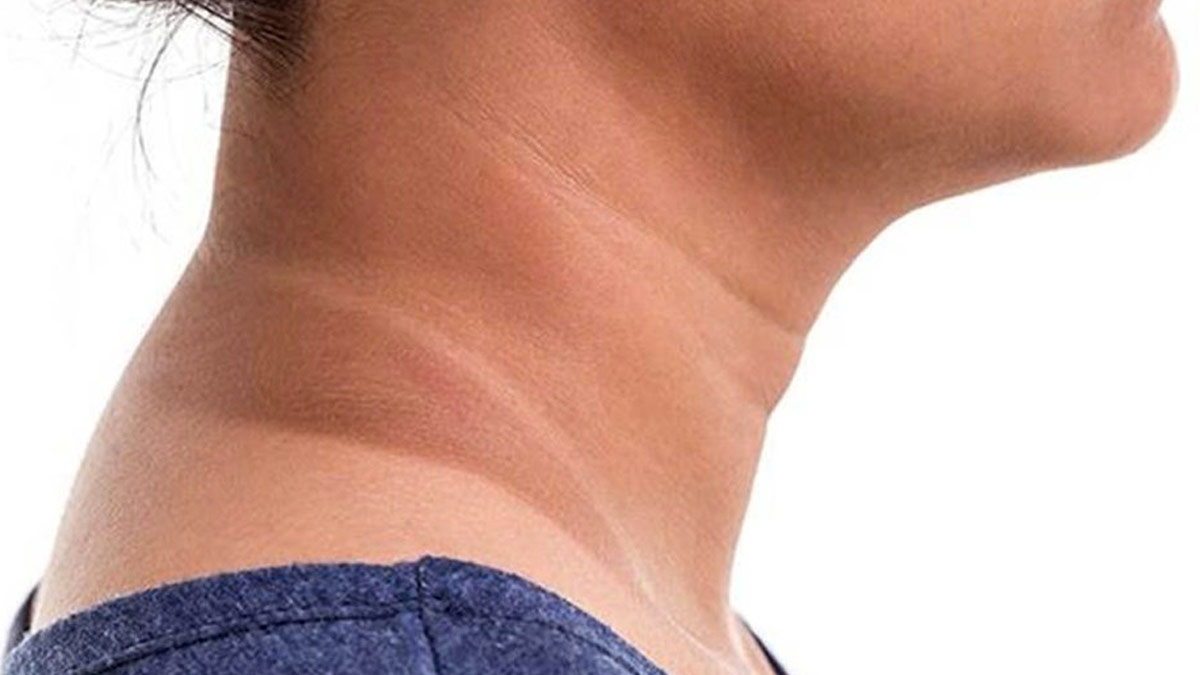 d tan neck gharelu nuskhe