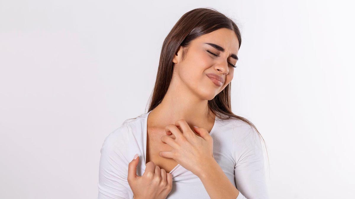 mosquito bite skin irritation