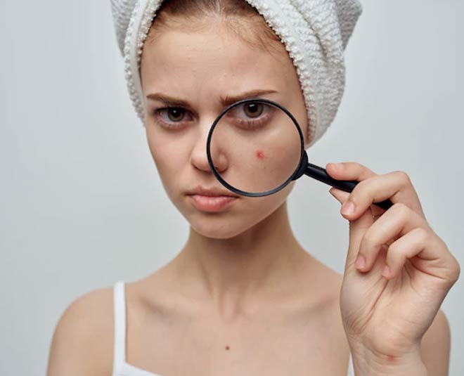 open pores band karne ke upay