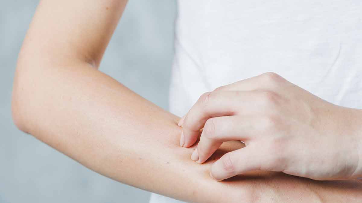 coconut oil and itching issues