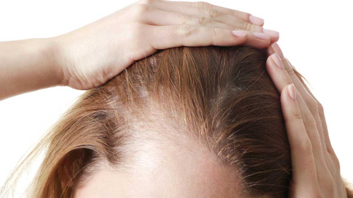 scalp and issues in summer