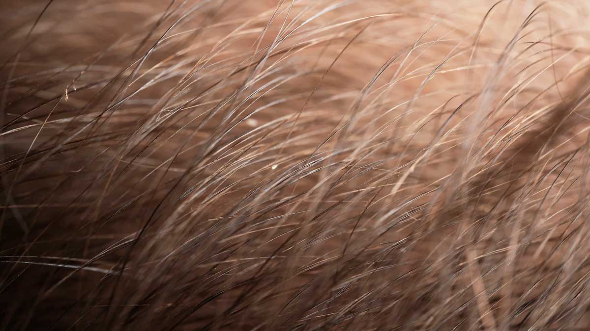 scalp problems for summer