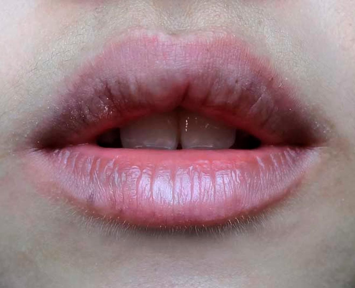 dark lips in winter