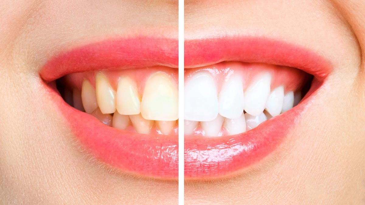 Yellow tooth powder in hindi