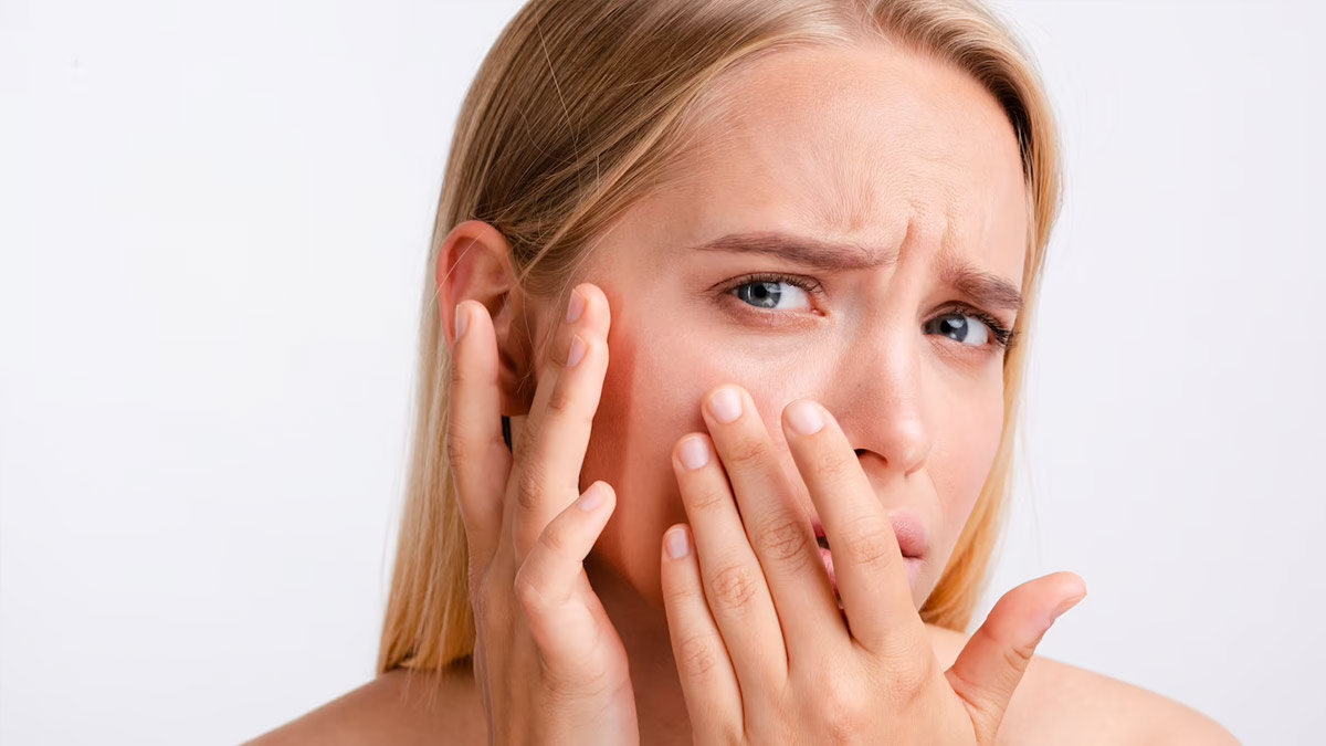 causes of whiteheads ()