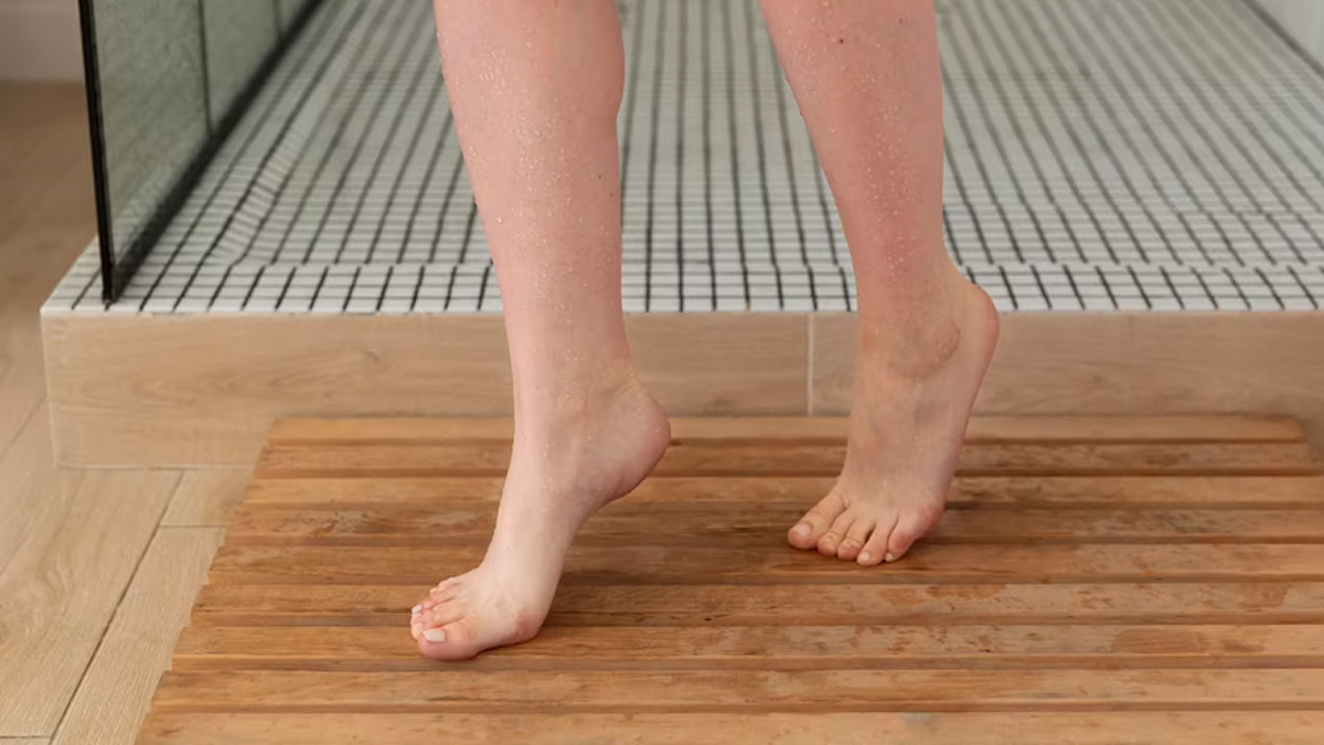 cracked heels remdies