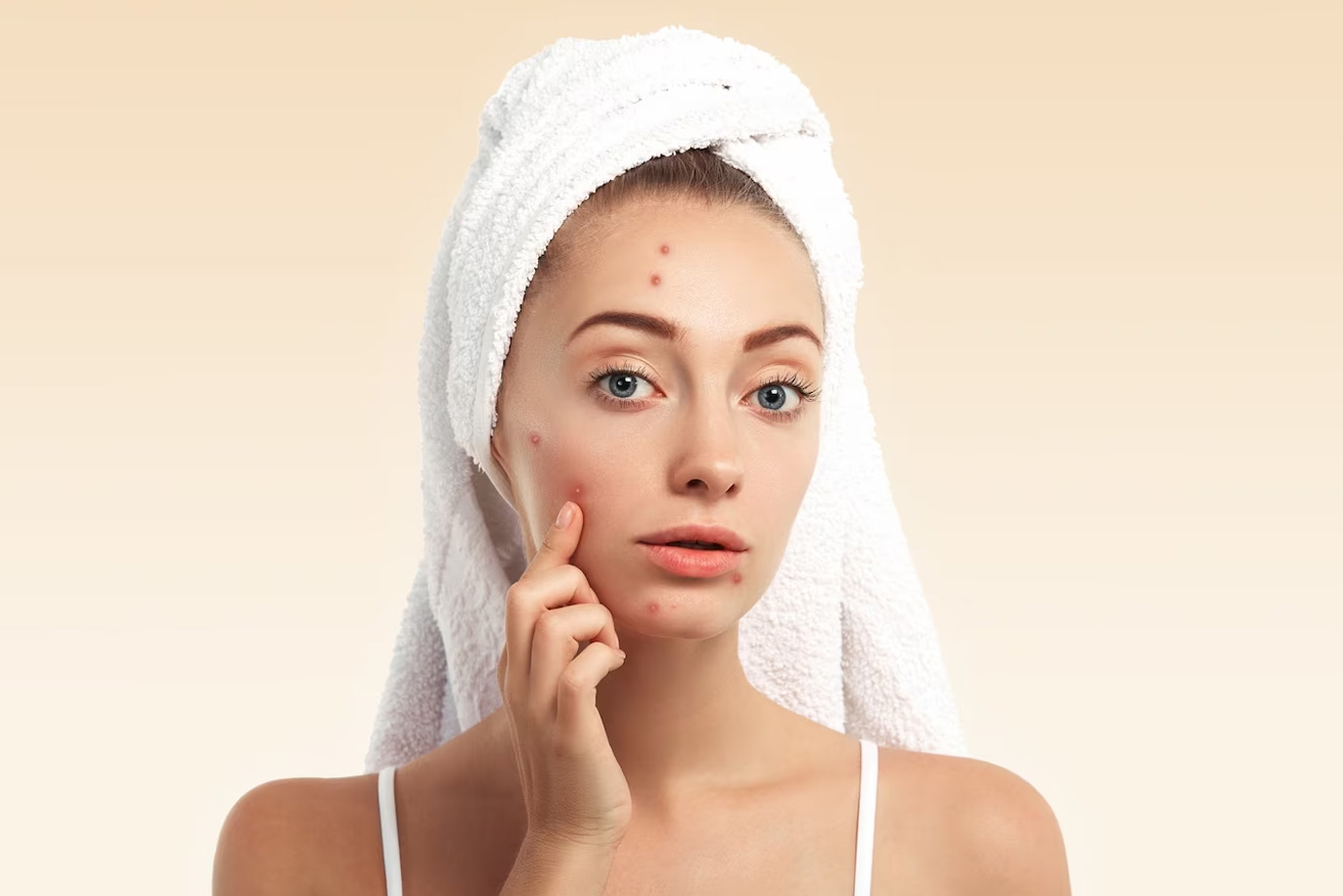 can clove water reduce acne