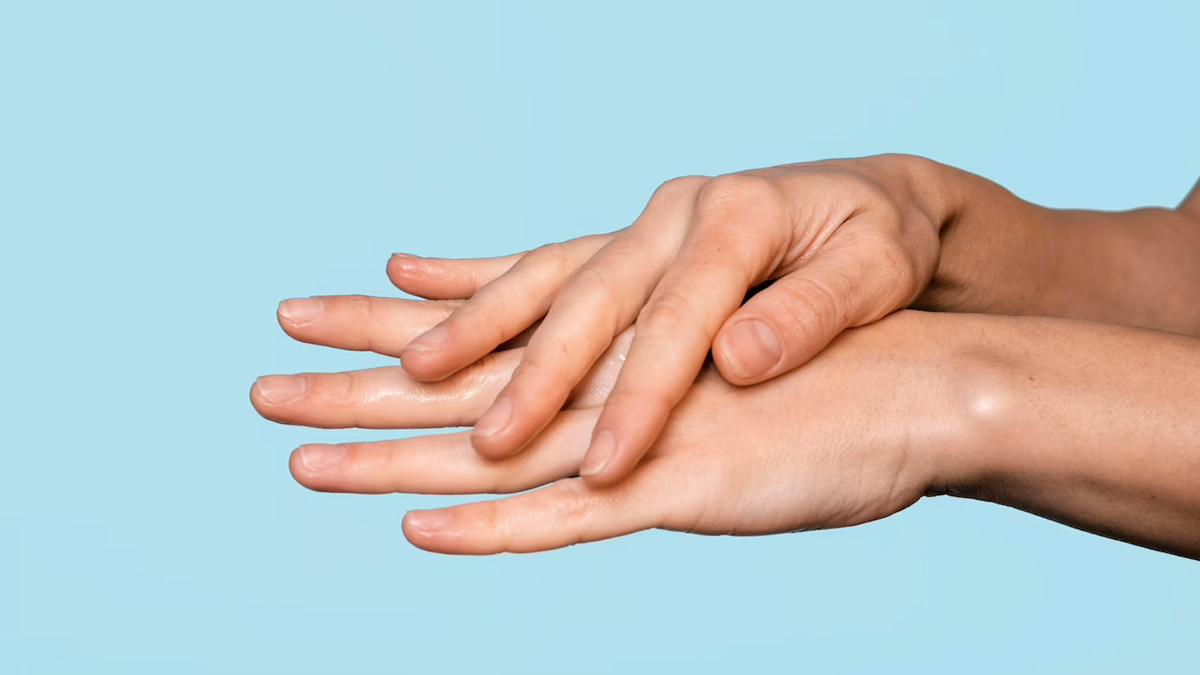 Hand cream dryness new pic