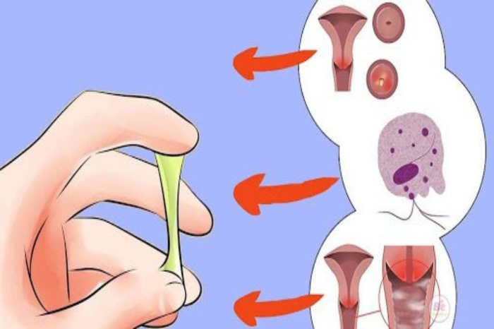 vaginal discharege ()