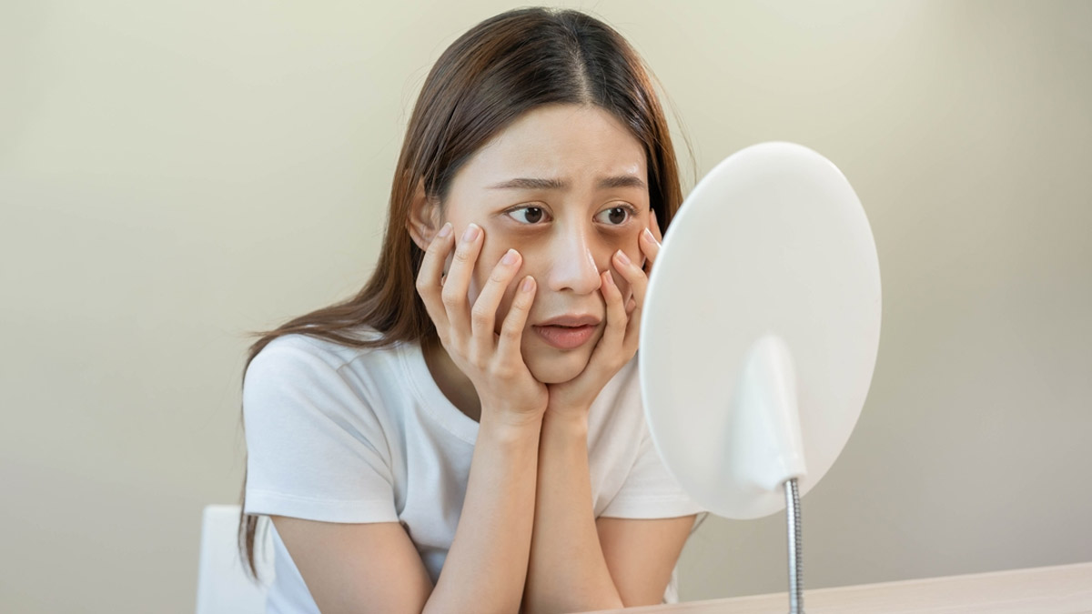 dark circle treatment at home