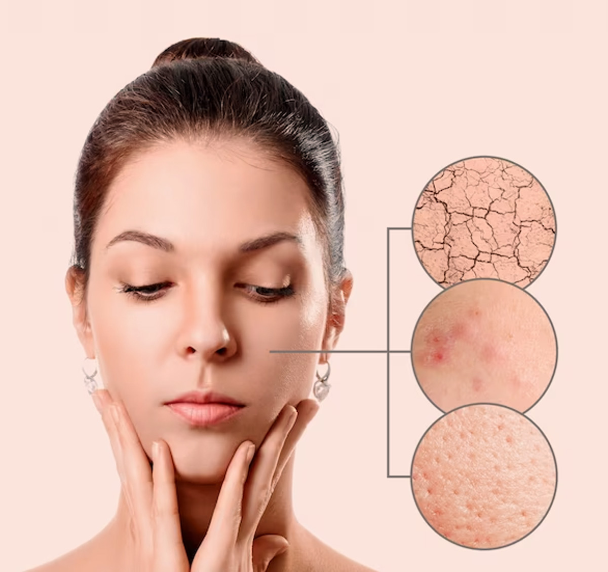 face skin problems in summer