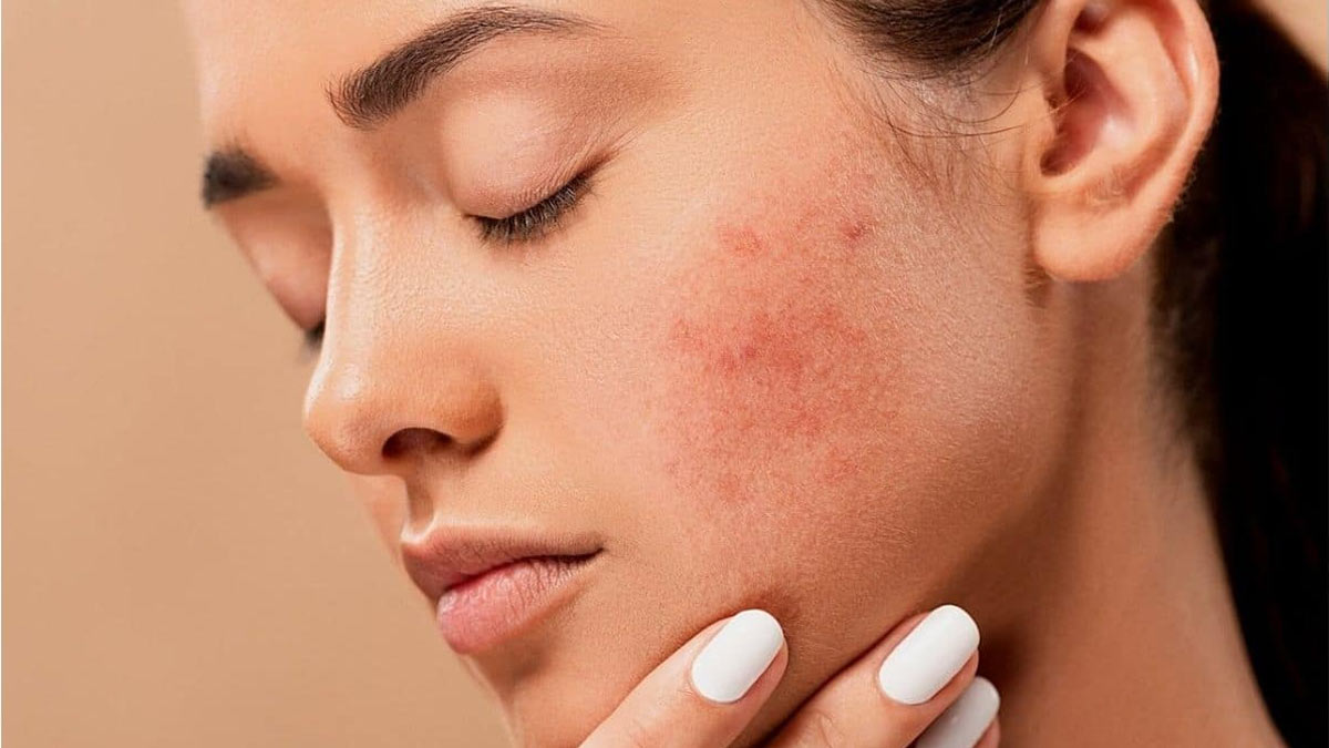 remedies for skin rashes