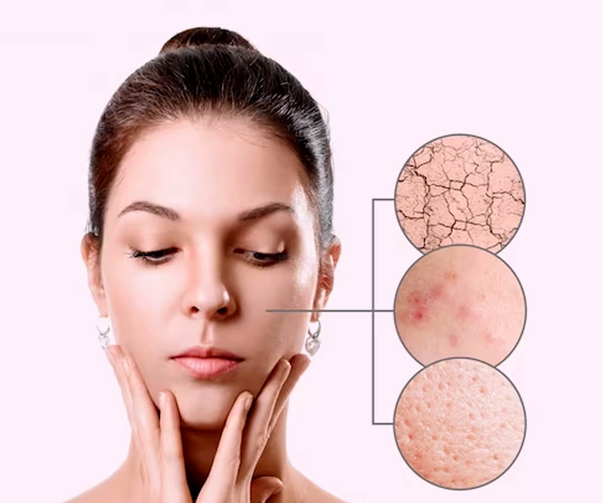 how to know your skin type