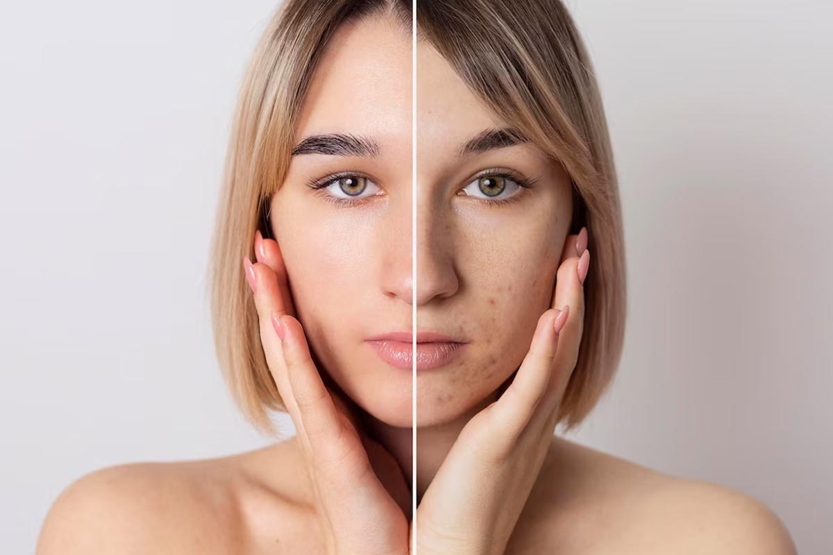 pores cleaning using cucumber pack