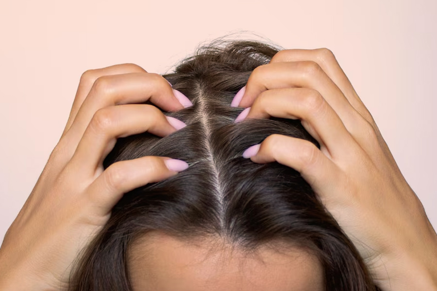 Use diy hair mask for reduce dandruff